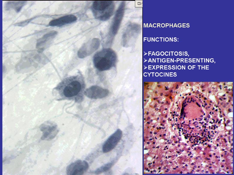 MACROPHAGES  FUNCTIONS:  FAGOCITOSIS, ANTIGEN-PRESENTING, EXPRESSION OF THE CYTOCINES